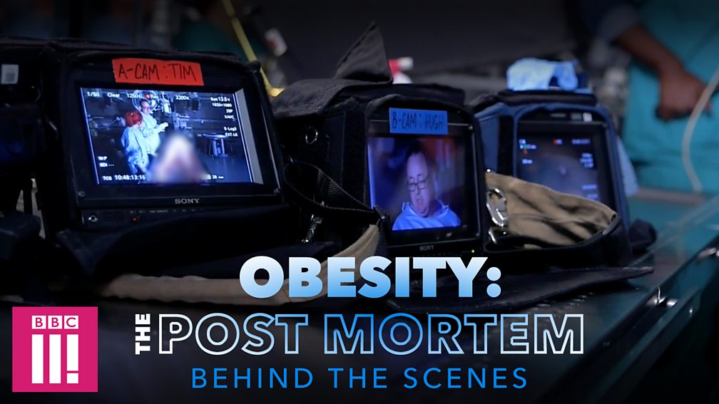 Obesity: The Post Mortem – Shocking Insights into the Hidden Dangers of Excess Weight